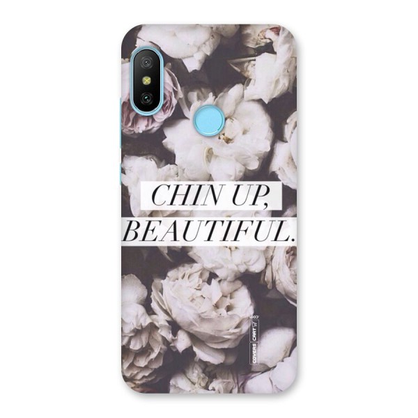 Chin Up Beautiful Back Case for Redmi 6 Pro