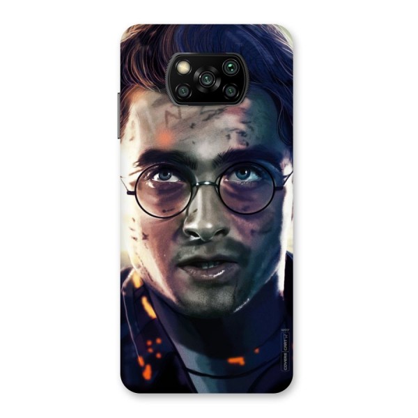 The Boy Who Lived Back Case for Poco X3