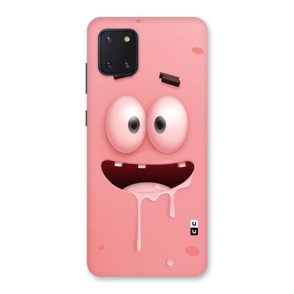 Watery Mouth Back Case for Galaxy Note 10 Lite