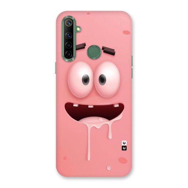 Watery Mouth Back Case for Realme Narzo 10