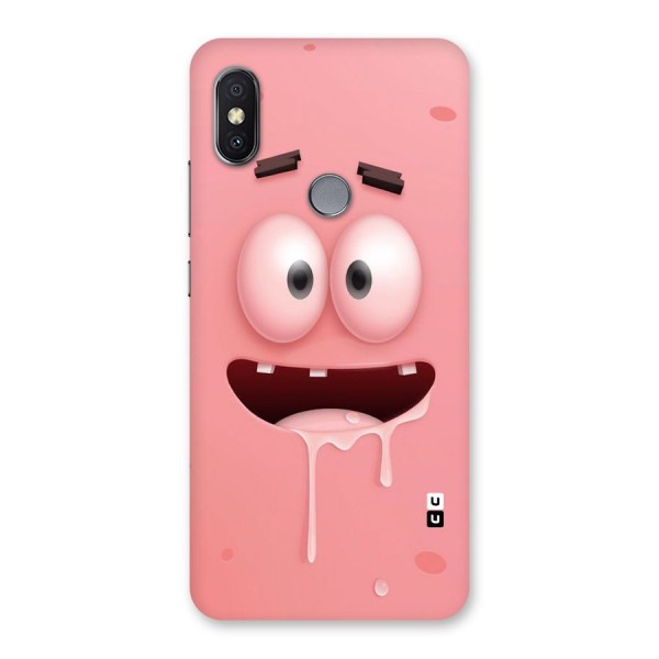 Watery Mouth Back Case for Redmi Y2
