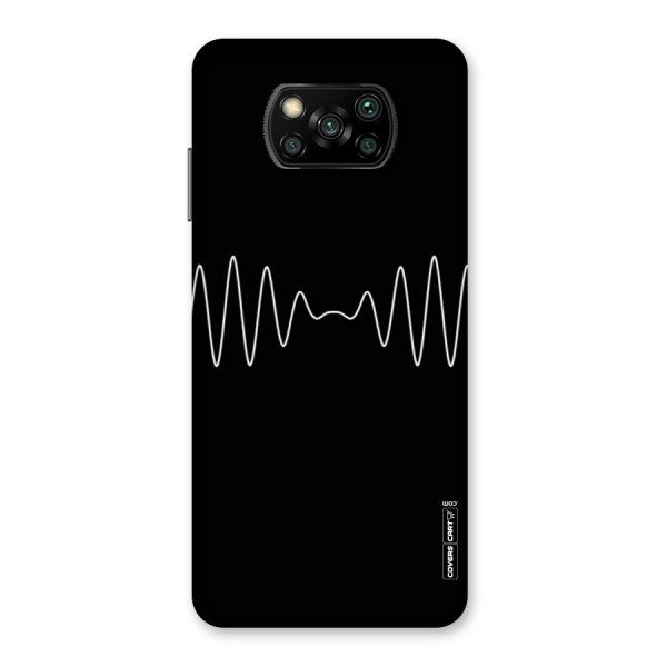 White Minimal Thread Back Case for Poco X3