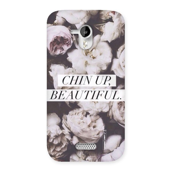 Chin Up Beautiful Back Case for Micromax Canvas HD A116