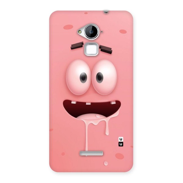 Watery Mouth Back Case for Coolpad Note 3