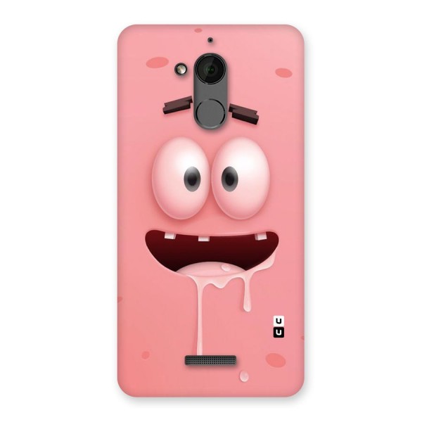 Watery Mouth Back Case for Coolpad Note 5