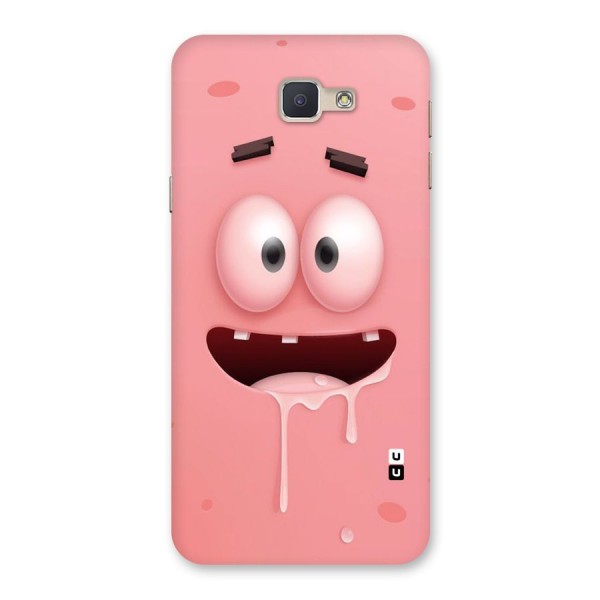 Watery Mouth Back Case for Galaxy J5 Prime