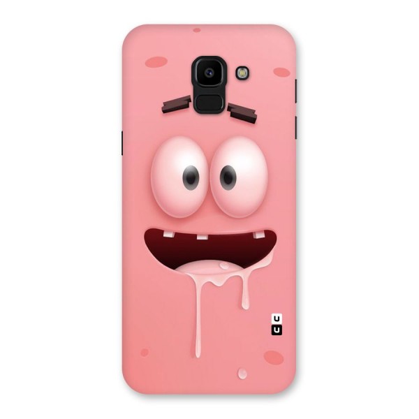 Watery Mouth Back Case for Galaxy J6