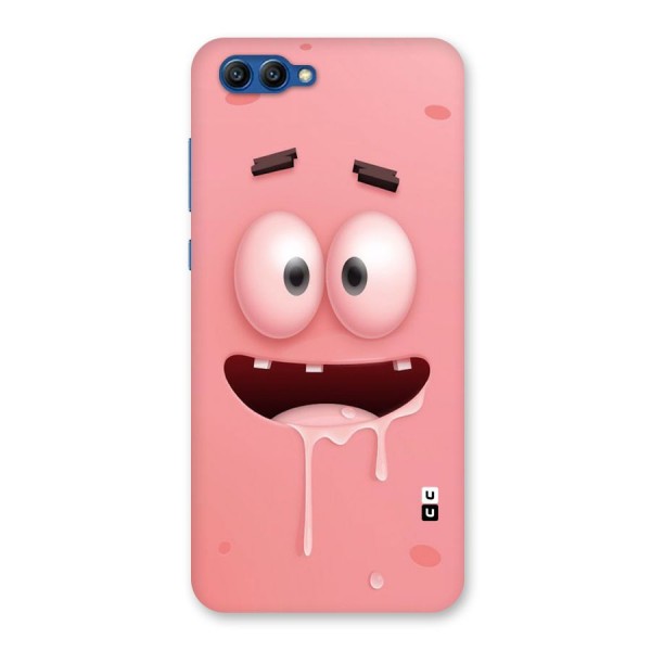 Watery Mouth Back Case for Honor View 10