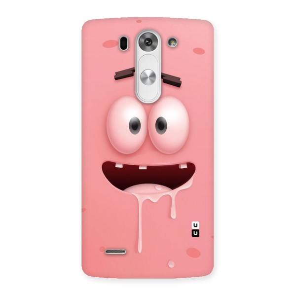 Watery Mouth Back Case for LG G3 Beat