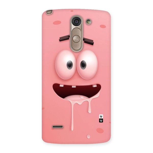 Watery Mouth Back Case for LG G3 Stylus