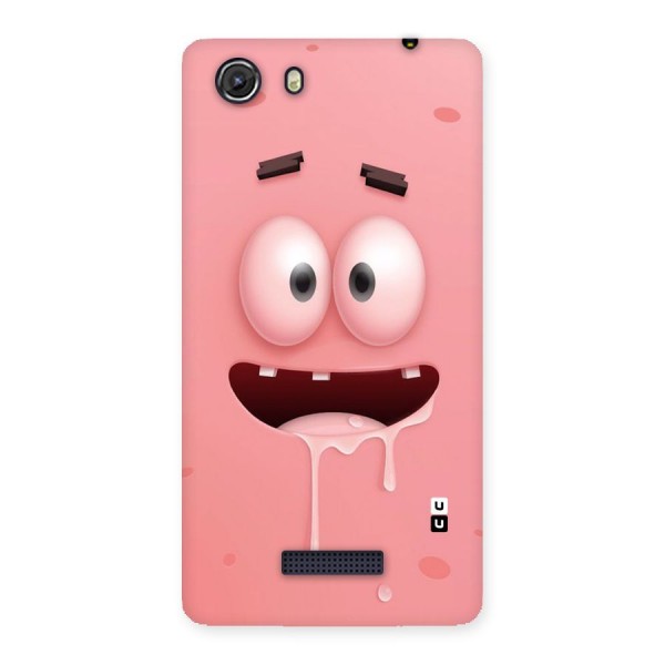 Watery Mouth Back Case for Micromax Unite 3