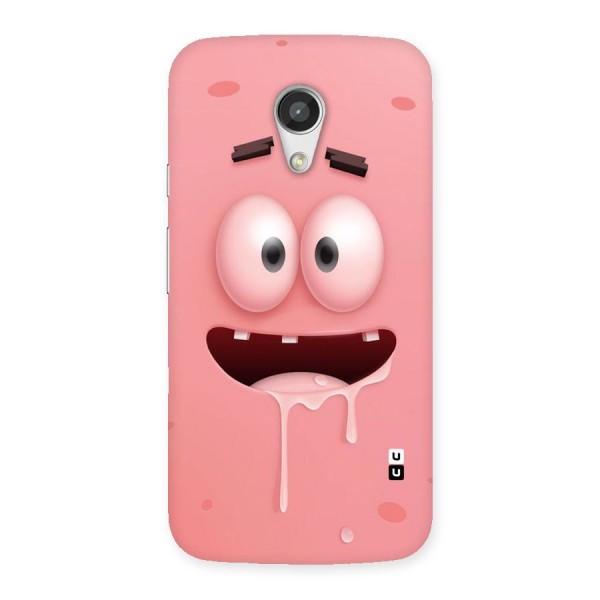 Watery Mouth Back Case for Moto G 2nd Gen