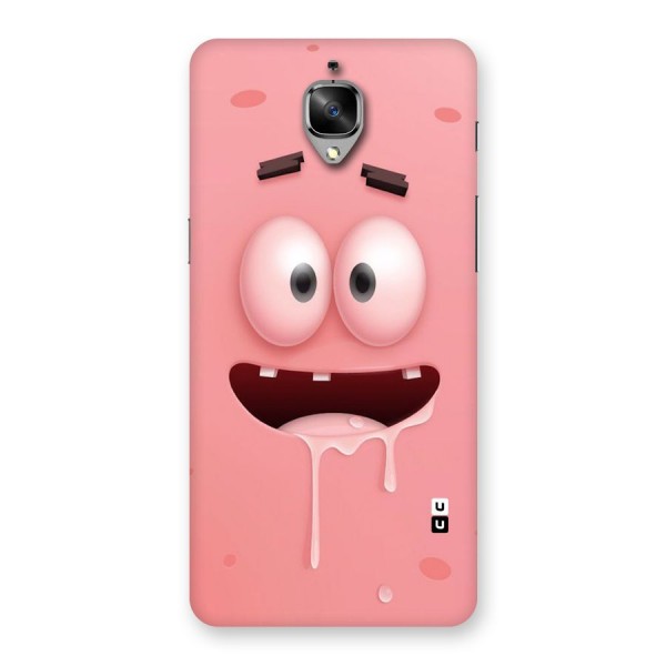 Watery Mouth Back Case for OnePlus 3T