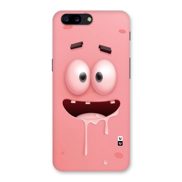 Watery Mouth Back Case for OnePlus 5