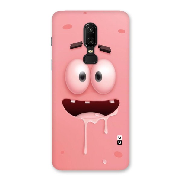 Watery Mouth Back Case for OnePlus 6