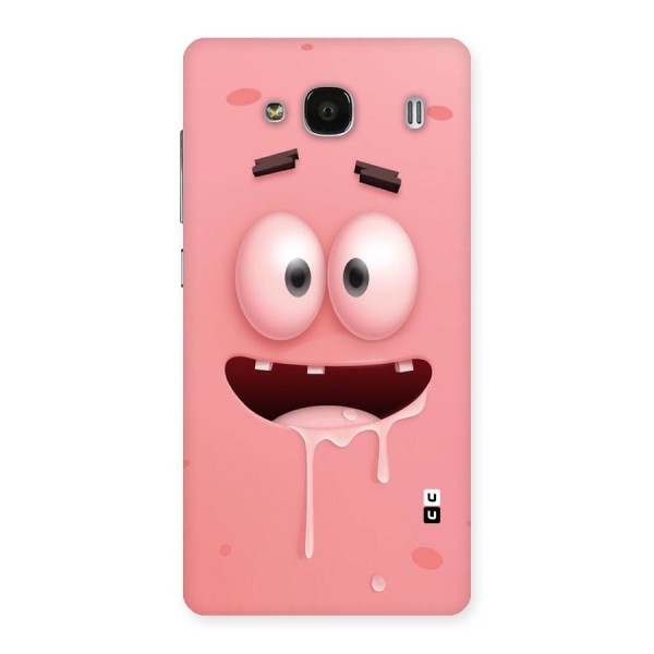 Watery Mouth Back Case for Redmi 2