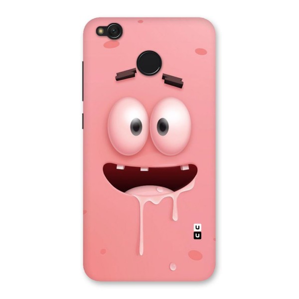 Watery Mouth Back Case for Redmi 4
