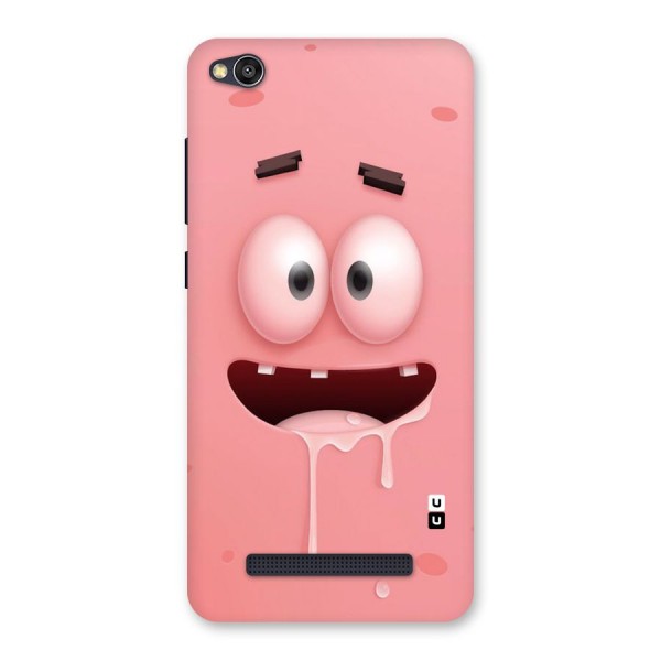 Watery Mouth Back Case for Redmi 4A