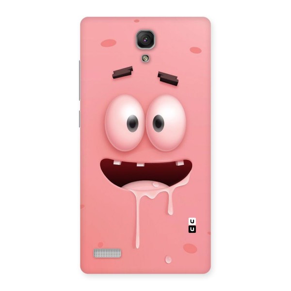 Watery Mouth Back Case for Redmi Note