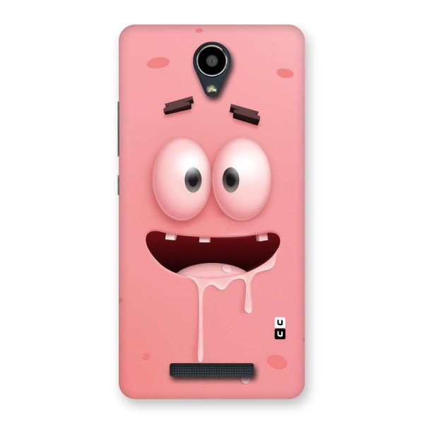 Watery Mouth Back Case for Redmi Note 2
