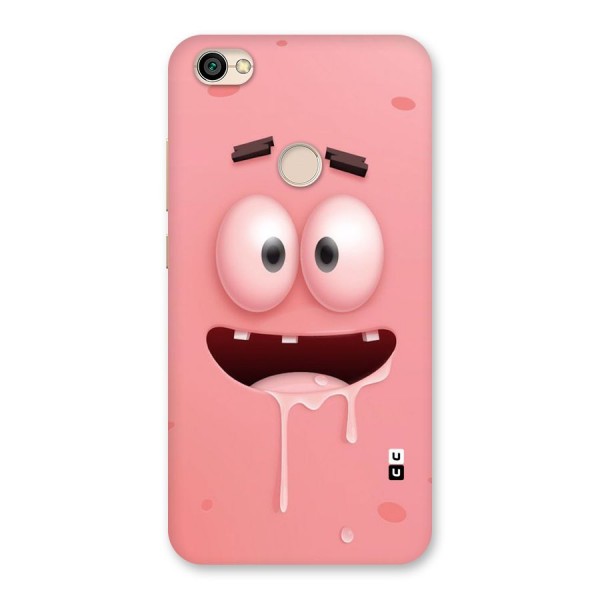 Watery Mouth Back Case for Redmi Y1 2017