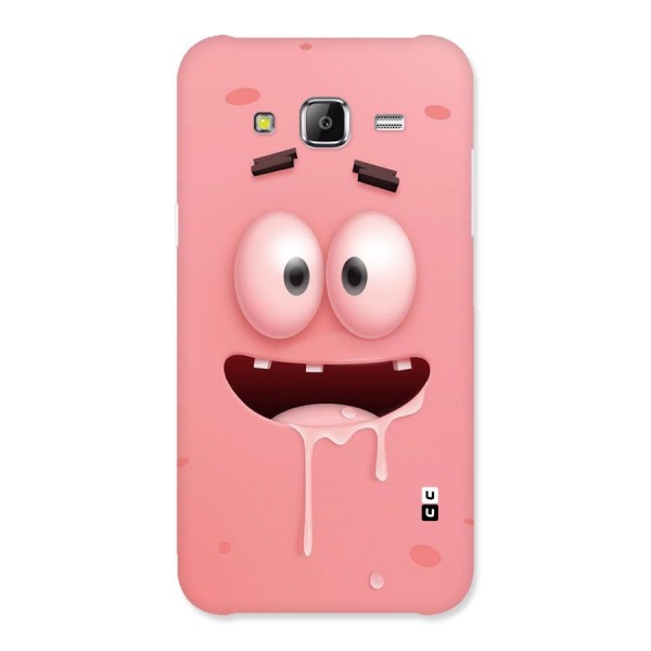Watery Mouth Back Case for Samsung Galaxy J2 Prime