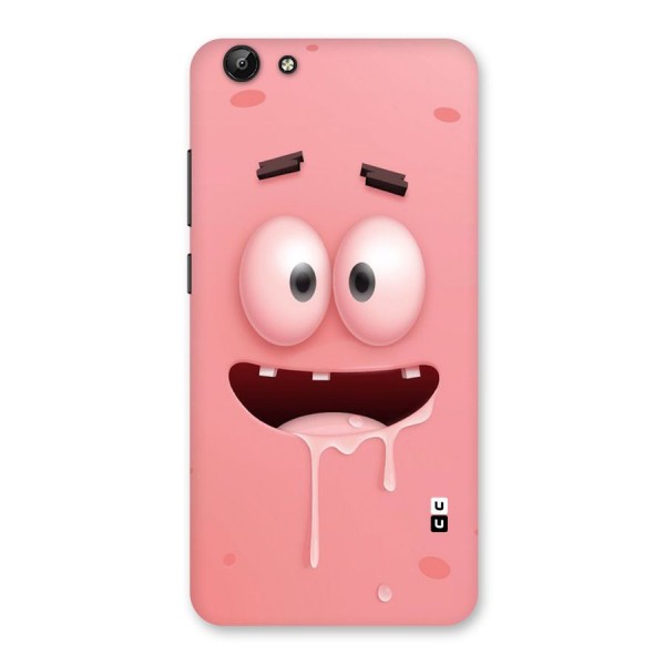 Watery Mouth Back Case for Vivo Y69