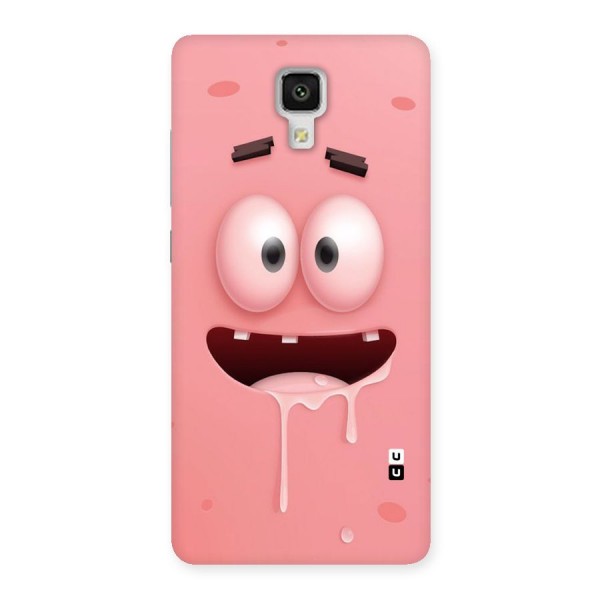 Watery Mouth Back Case for Xiaomi Mi 4