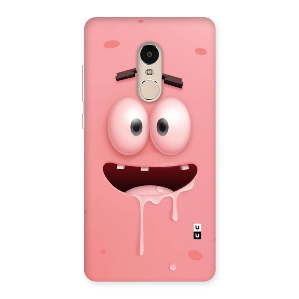 Watery Mouth Back Case for Xiaomi Redmi Note 4