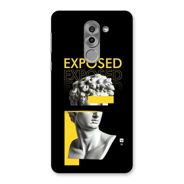 Exposed Sculpture Back Case for Honor 6X