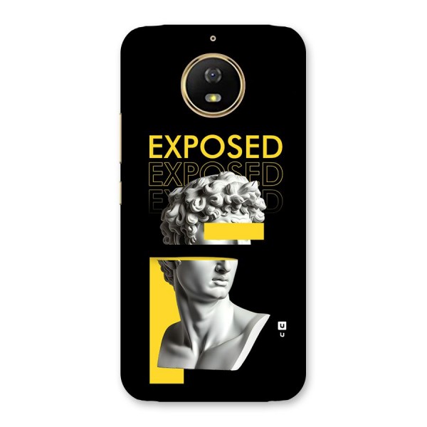 Exposed Sculpture Back Case for Moto G5s
