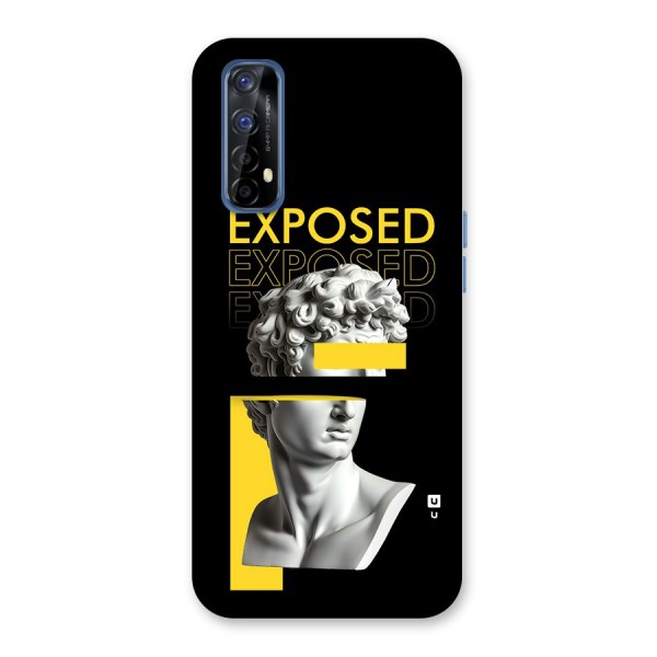 Exposed Sculpture Back Case for Realme Narzo 20 Pro