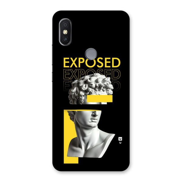 Exposed Sculpture Back Case for Redmi Y2
