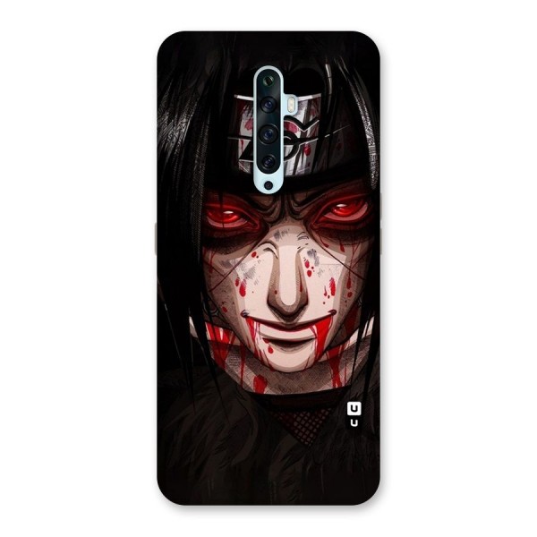 Itachi Uchiha Red Eyes Back Case for Oppo Reno2 F