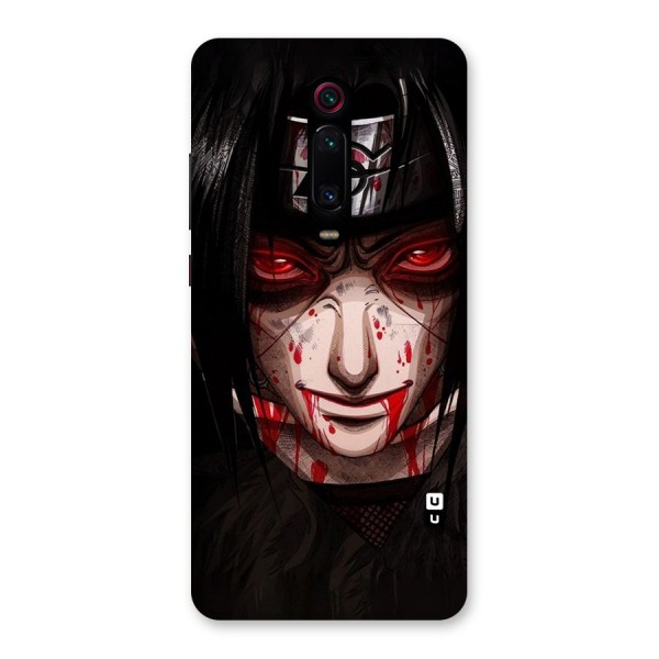 Itachi Uchiha Red Eyes Back Case for Redmi K20 Pro