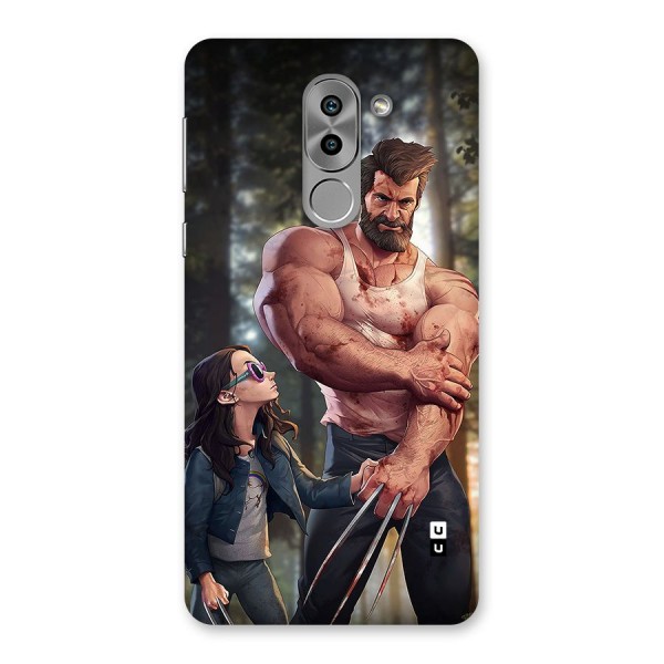 Laura Logan Back Case for Honor 6X