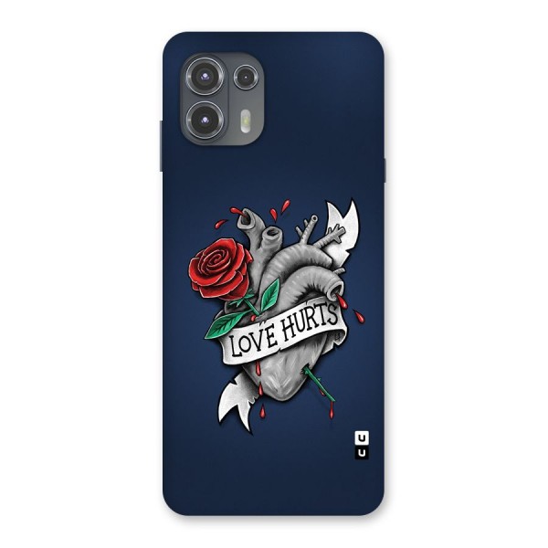 Love Hurts Back Case for Motorola Edge 20 Fusion