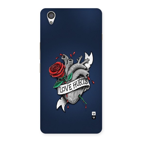 Love Hurts Back Case for OnePlus X