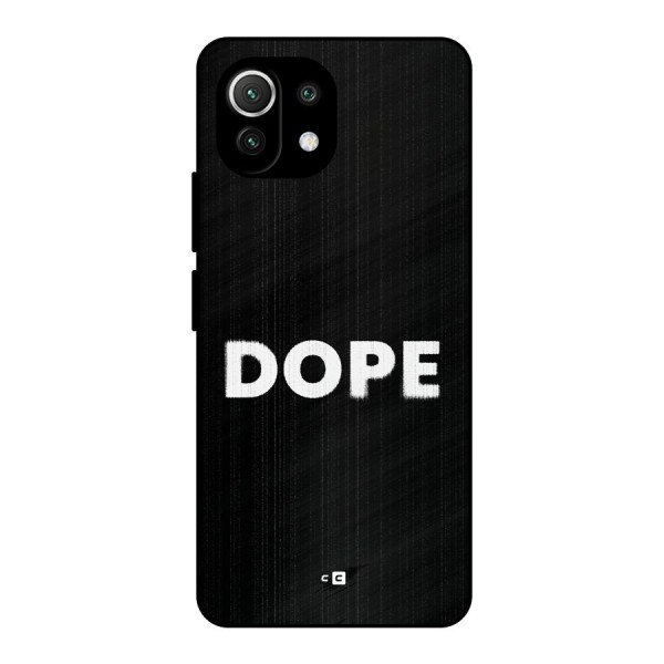 Sense Alert Metal Back Case for Mi 11 Lite