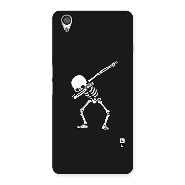 Skeleton Dab White Back Case for OnePlus X